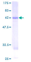 12.5% SDS-PAGE Stained with Coomassie Blue.